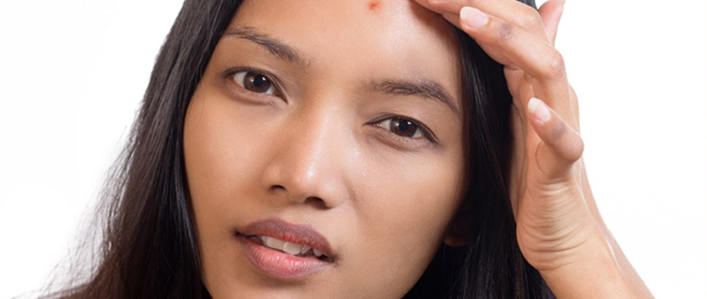Is it safe to use dettol on face