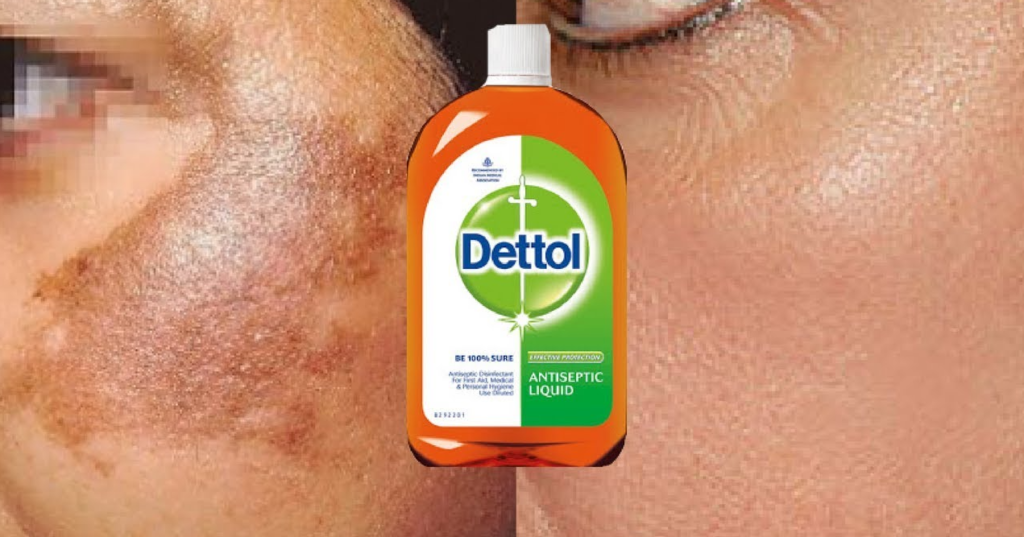 Is it safe to use dettol on face