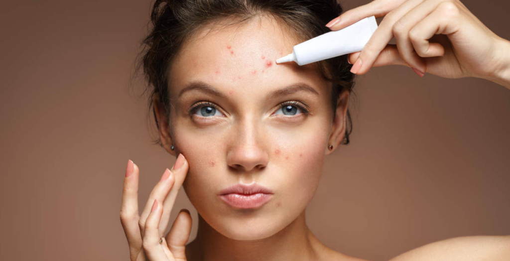 Can you apply benzoyl peroxide on face ?